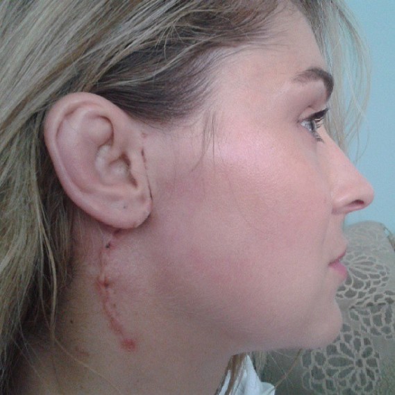 Марлус Кунен