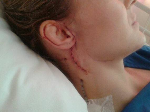 Марлус Кунен